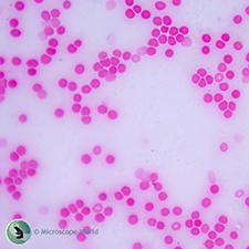 Human blood under the compound microscope. Human blood under the microscope.