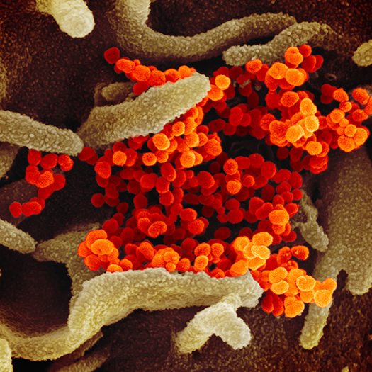 Scanning Electron Microscope Image of Virus that Causes COVID-19 Scanning Electron Microscope Image of Virus that Causes COVID-19