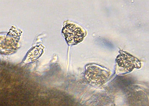 Stalked Ciliate under Microscope in Wastewater Stalked Ciliate under Microscope in Wastewater