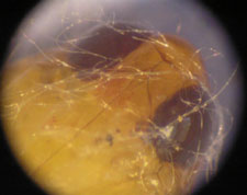Moth Pupa Under Stereo Microscope at 60x Moth Pupa Under Stereo Microscope at 60x