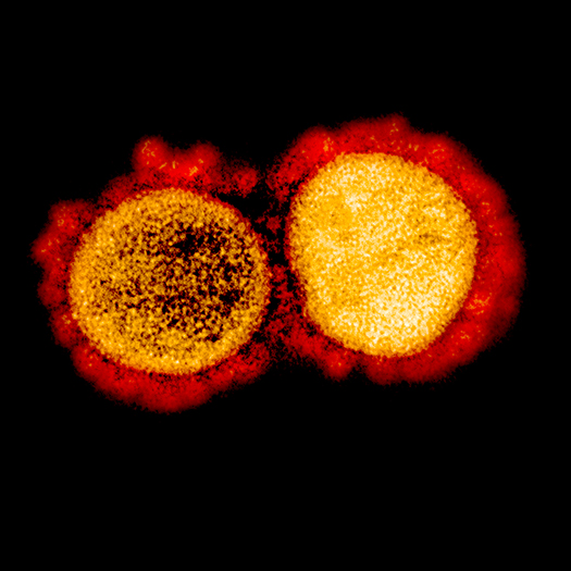 SARS-CoV-2 Virus Under the TEM Corona Virus Captured Under the Microscope