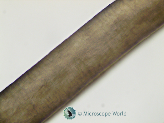 Hair shaft focused on the top of the shaft Hair shaft under the microscope 400x