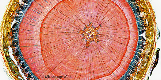 Woody Stem Cross Section Image Stitching under Microscope Woody Stem Cross Section Image Stitching under Microscope