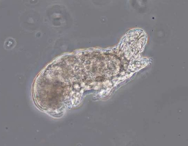 Waterbear in wastewater under the microscope Waterbear in wastewater under the microscope